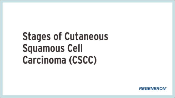 Animated stages of cutaneous squamous cell carcinoma (CSCC) Visualization follows the progression of cutaneous squamous cell carcinoma (CSCC) from localized CSCC, through locally advanced and metastatic CSCC stages. Tumors spread from localized areas to underlying tissues, muscles and nerves, causing damage to heathy tissue until they eventually spread beyond their original location to other parts of the body.